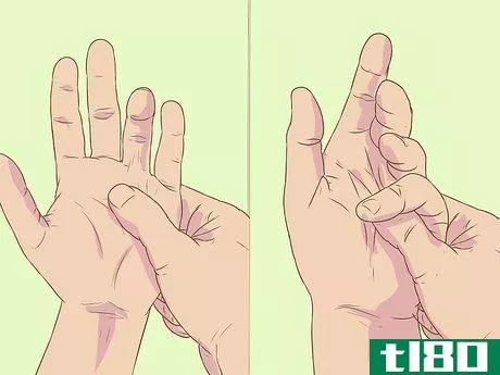Image titled Diagnose Dupuytren's Contracture Step 11