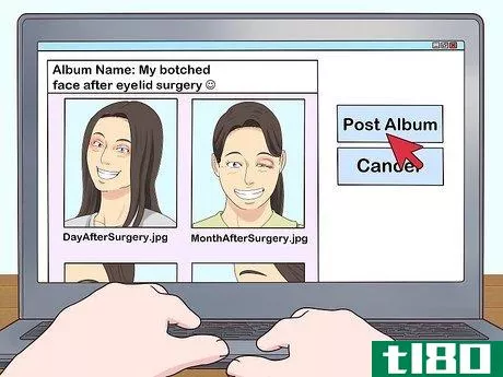 Image titled Get Cast for the TV Show Botched Step 5