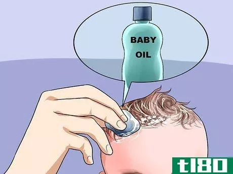 Image titled Easily Clean Baby's Cradle Cap Dandruff Without Hurting the Baby Step 1