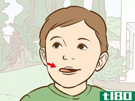 Image titled Fix a Toddler's Chapped Lips Step 4
