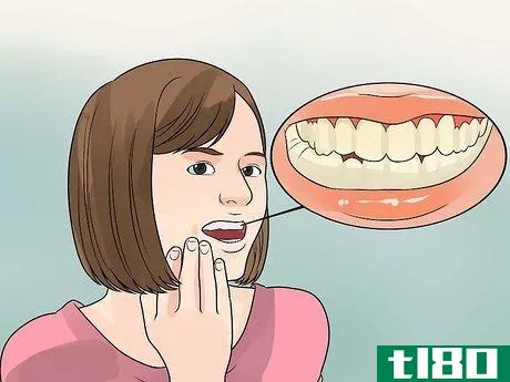 Image titled Determine if a Tooth Needs to Be Pulled Step 1