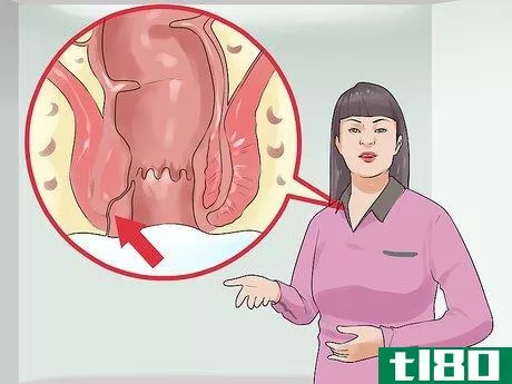 Image titled Explain Crohn's Disease to Others Step 4