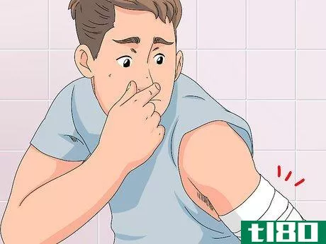 Image titled Determine if a Burn Is Infected Step 5
