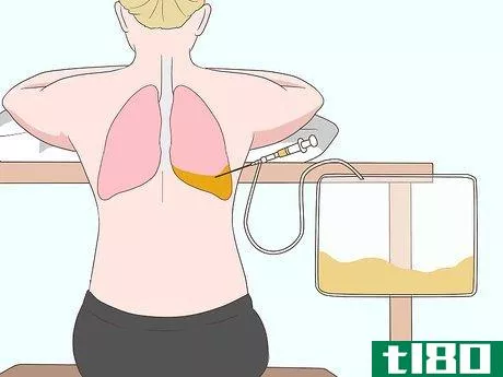 Image titled Ease Pleurisy Pain Step 5