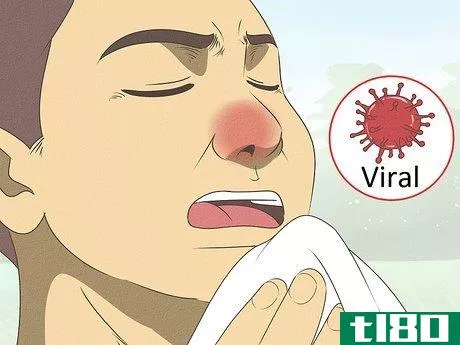 Image titled Differentiate Bacterial Tonsillitis and Viral Tonsillitis Step 1