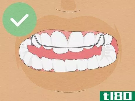 Image titled Fix Crooked Teeth Step 11