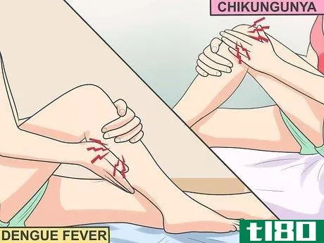 Image titled Ease Muscle Pain from Chikungunya Step 3