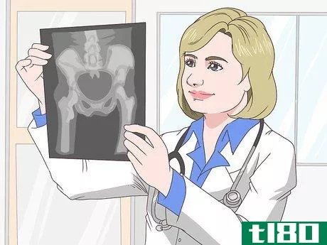 Image titled Diagnose a Fistula Step 8