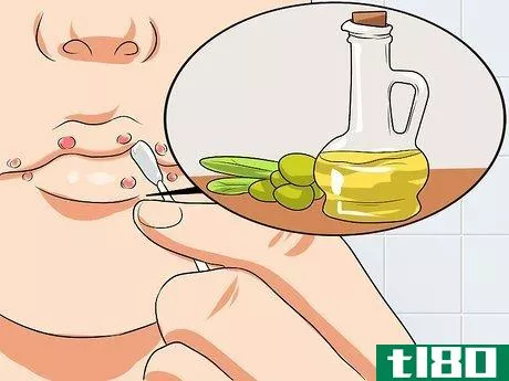 Image titled Ease Herpes Pain with Home Remedies Step 6