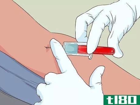 Image titled Diagnose Multiple Myeloma Step 7