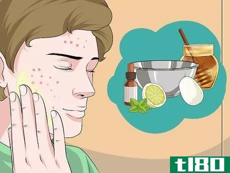 Image titled Dry Out a Pimple Step 10