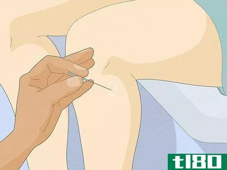 Image titled Ease Constipation with Acupuncture Step 3