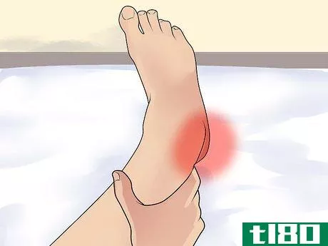 Image titled Diagnose Heel Spurs Step 1
