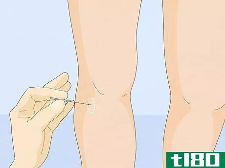 Image titled Ease Constipation with Acupuncture Step 4