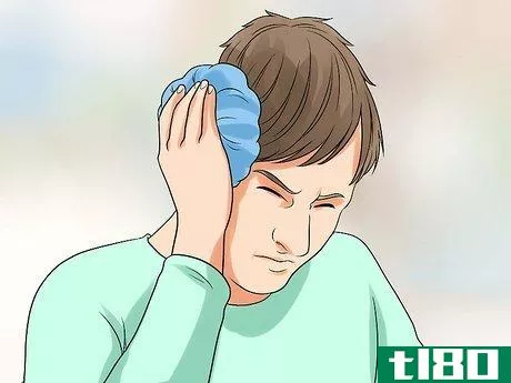 Image titled Drain Cauliflower Ear Step 1