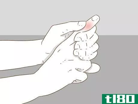 Image titled Determine if a Finger Is Broken Step 14