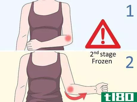Image titled Diagnose a Frozen Shoulder Step 2