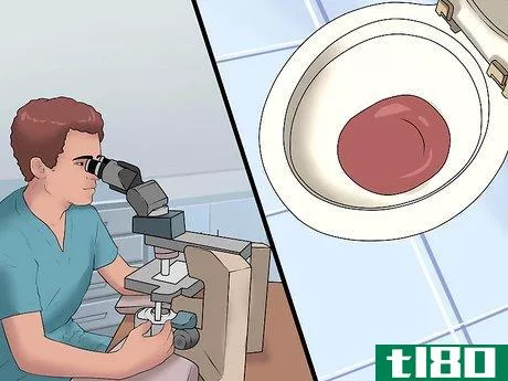 Image titled Detect Blood in Urine Step 10