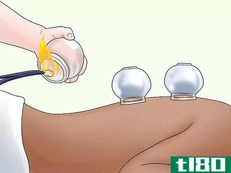 Image titled Do Cupping Step 1