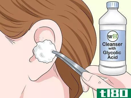 Image titled Get Blackheads Out of Your Ear Step 1