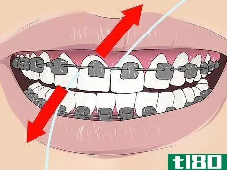 Image titled Floss With Braces Step 4