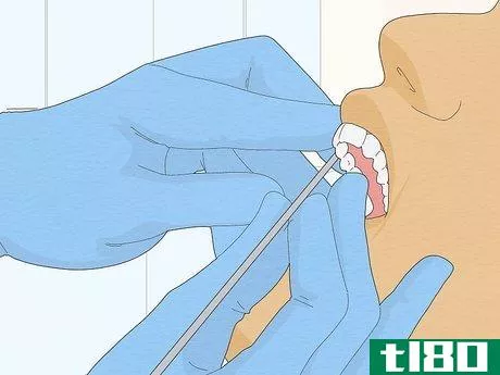 Image titled Fix Crooked Teeth Step 21