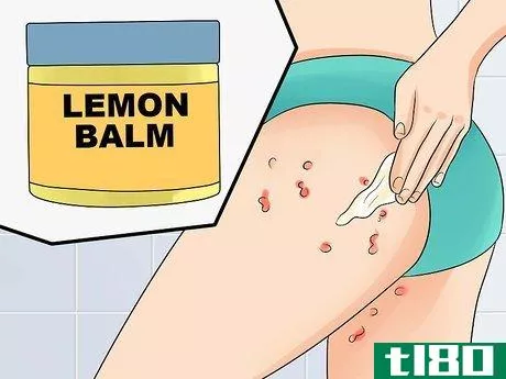 Image titled Ease Herpes Pain with Home Remedies Step 14