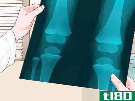 Image titled Diagnose Low Bone Density in Kids Step 3