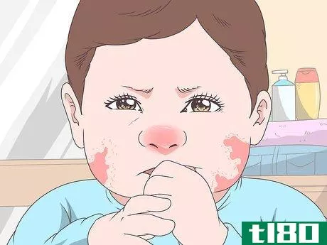 Image titled Diagnose Allergic Colitis in Babies Step 4