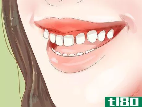 Image titled Determine if You Need Braces Step 3
