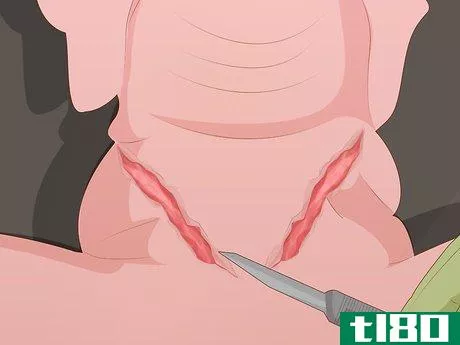 Image titled Dissect a Fetal Pig Step 9