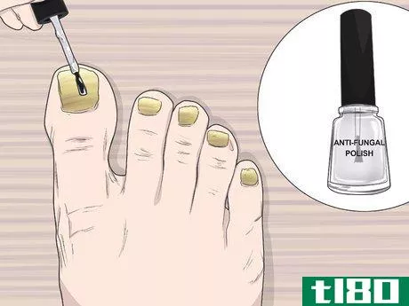 Image titled Do a Nail Treatment Step 2