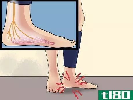 Image titled Diagnose Heel Spurs Step 5