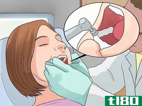Image titled Determine if a Tooth Needs to Be Pulled Step 15