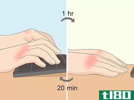 Image titled Fix Knuckle Pain Step 1