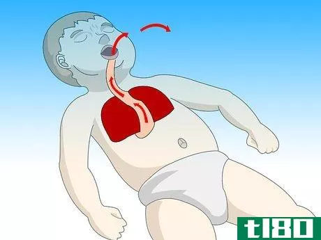 Image titled Do First Aid on a Choking Baby Step 8