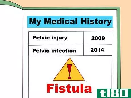 Image titled Diagnose a Fistula Step 16