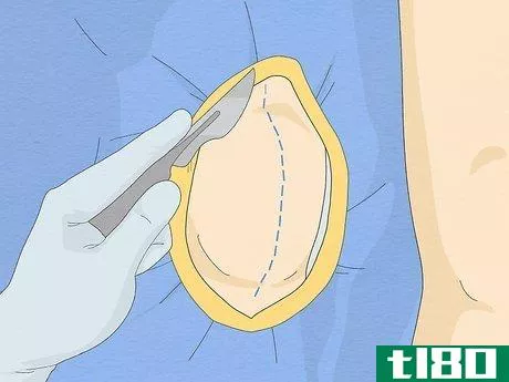 Image titled Fix Knee Pain Step 11