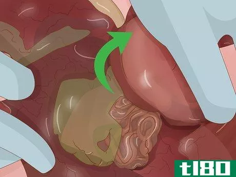 Image titled Dissect a Fetal Pig Step 17