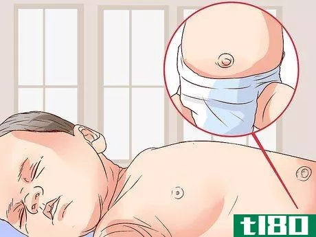 Image titled Diagnose a Child's Hernia Step 1