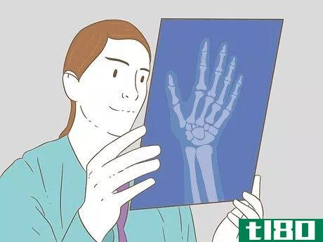 Image titled Determine if a Finger Is Broken Step 6
