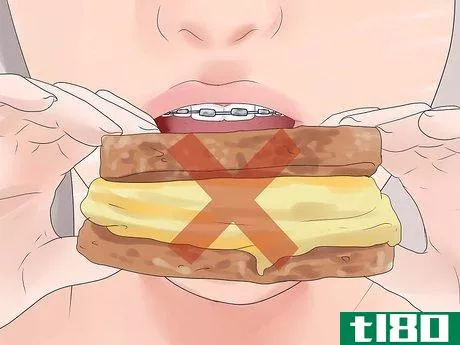 Image titled Eat With Braces Step 7