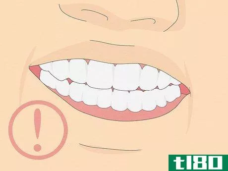 Image titled Fix Crooked Teeth Step 16