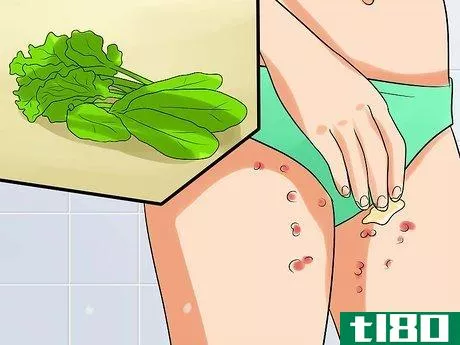Image titled Ease Herpes Pain with Home Remedies Step 15