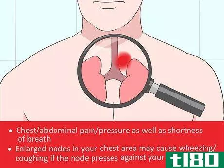 Image titled Diagnose Castleman Disease Step 2