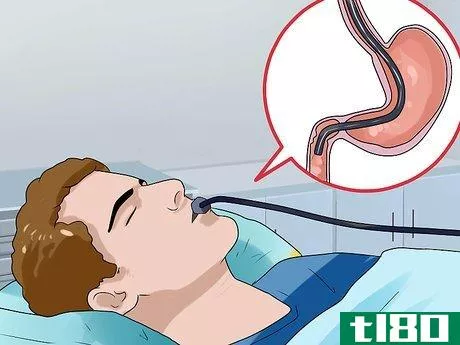 Image titled Diagnose and Treat Esophageal Cancer Step 9