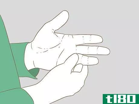 Image titled Determine if a Finger Is Broken Step 1