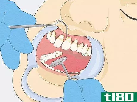 Image titled Fix Rotting Teeth Step 5
