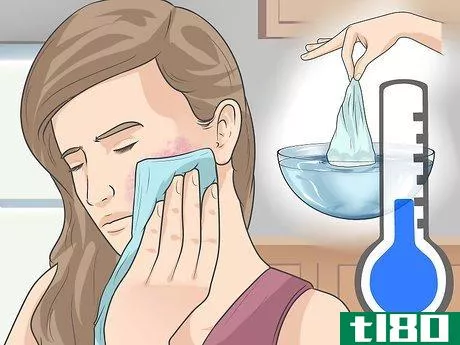 Image titled Get Rid of Hives on the Face Step 1
