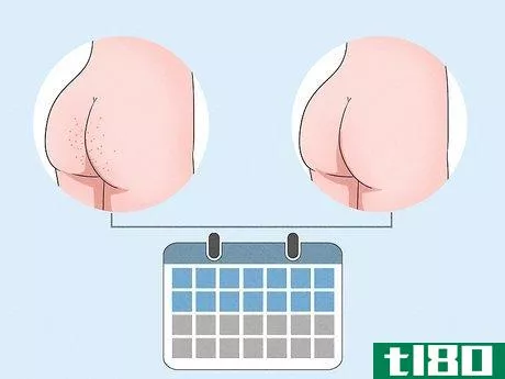 Image titled Get Rid of Acne on the Buttocks Step 11